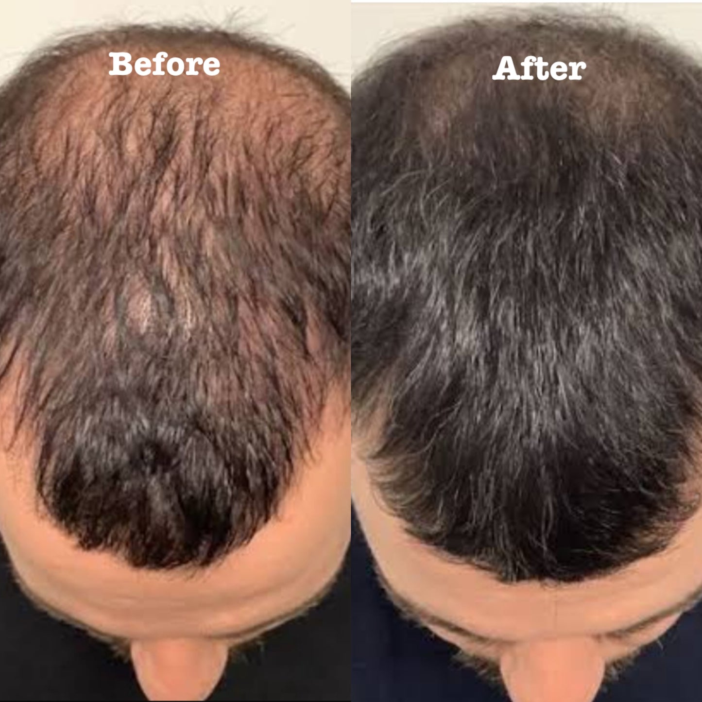 ZarbSabz Premium Herbal Hair Oil | Strong, Healthy & Shiny Hair